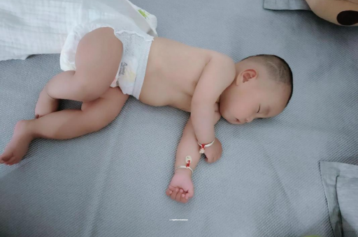 通辽六个月宝宝眼睛散光